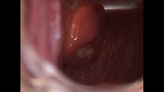 Avy Open Pussy Speculum